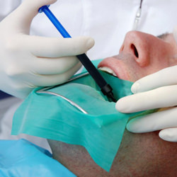 Root Canal Therapy